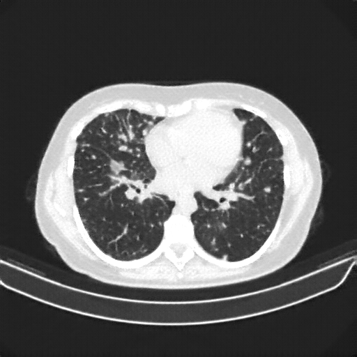 Generated VENOUS CT scan (A→B translation)