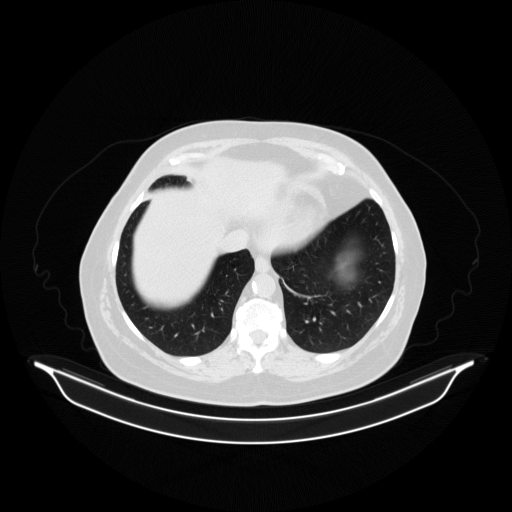 Original NATIVE CT scan (input)