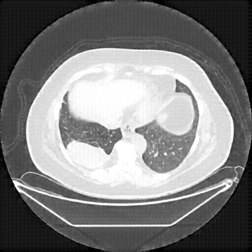 Generated VENOUS CT scan (A→B translation)