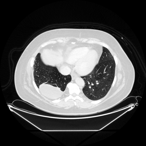 Original VENOUS CT scan