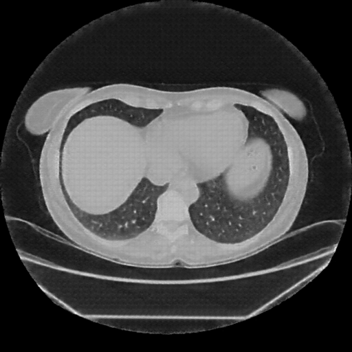 Generated VENOUS CT scan (A→B translation)
