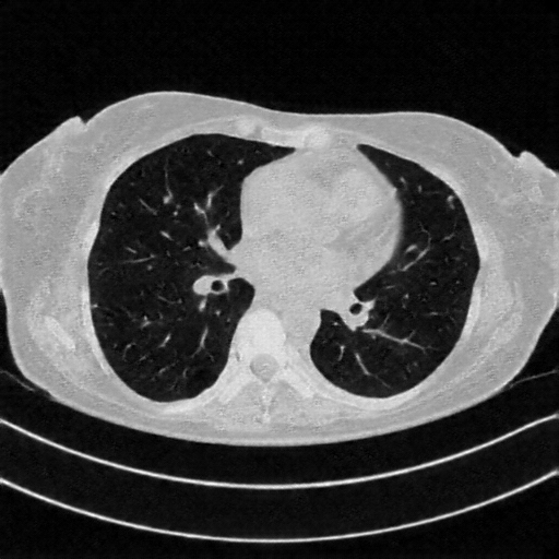 Generated VENOUS CT scan (A→B translation)