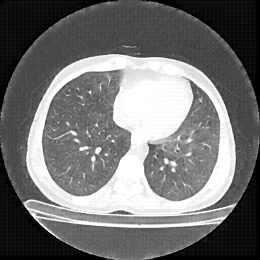 Generated VENOUS CT scan (A→B translation)