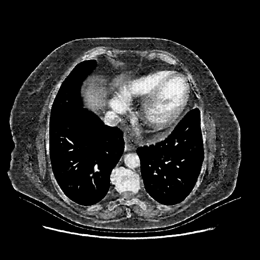 Generated VENOUS CT scan (A→B translation)