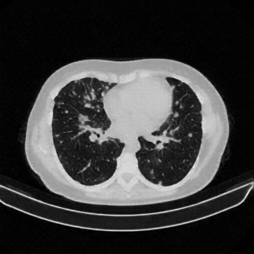 Generated VENOUS CT scan (A→B translation)