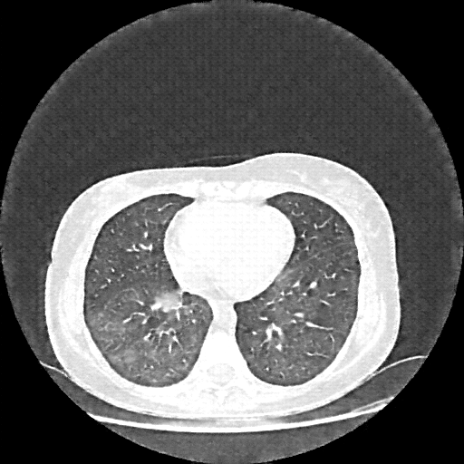 Generated VENOUS CT scan (A→B translation)