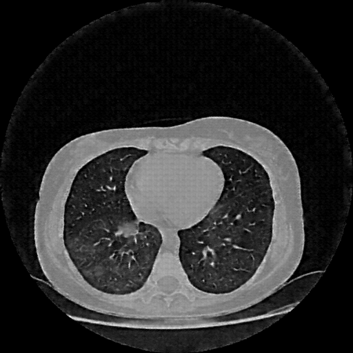 Generated VENOUS CT scan (A→B translation)