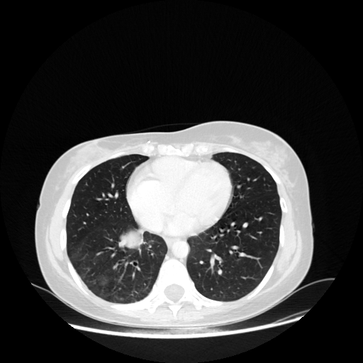 Original VENOUS CT scan