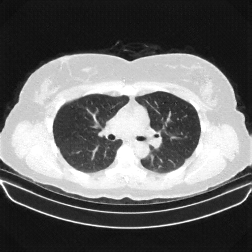 Generated VENOUS CT scan (A→B translation)