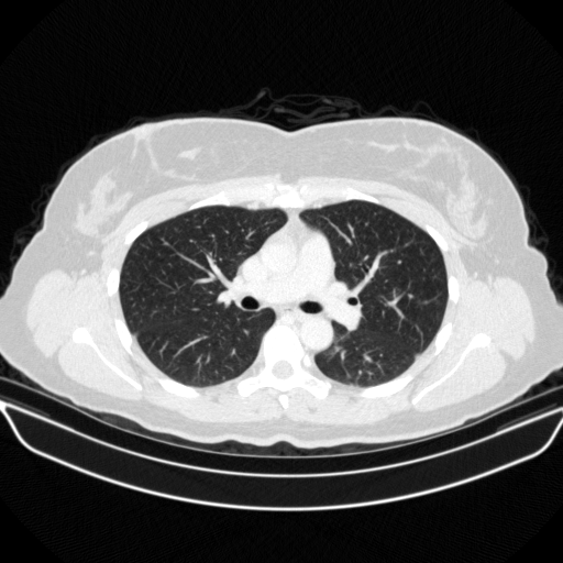 Original VENOUS CT scan
