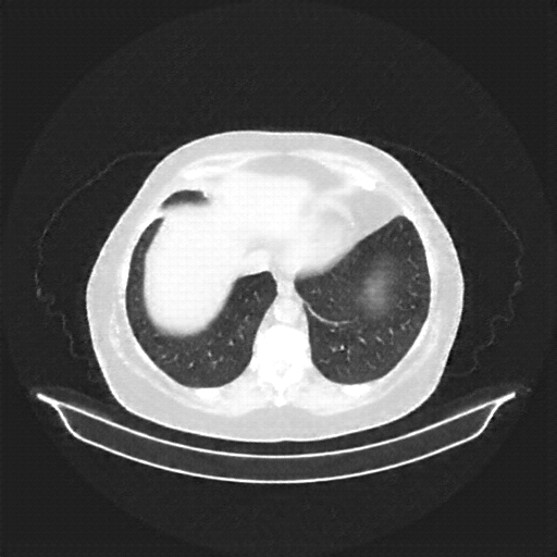 Generated VENOUS CT scan (A→B translation)