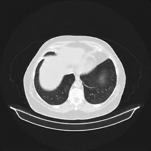 Reconstructed NATIVE CT scan (cycle consistency)
