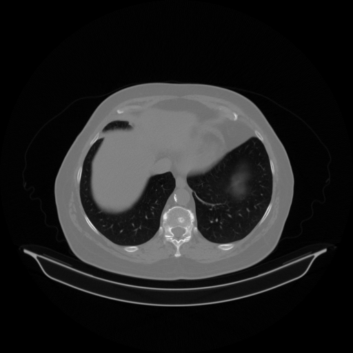 Original NATIVE CT scan (input)