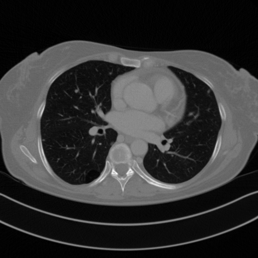 Original VENOUS CT scan