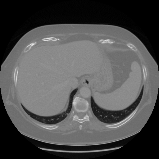 Original VENOUS CT scan