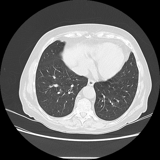 Original NATIVE CT scan (input)