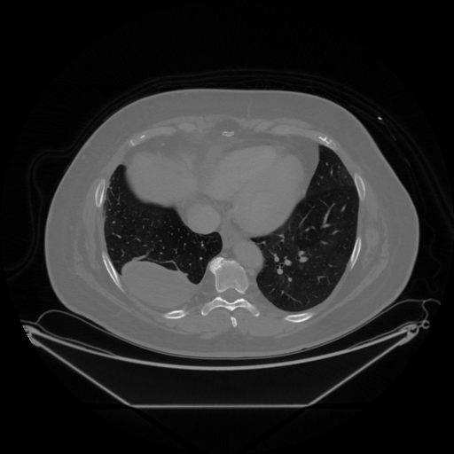 Original VENOUS CT scan