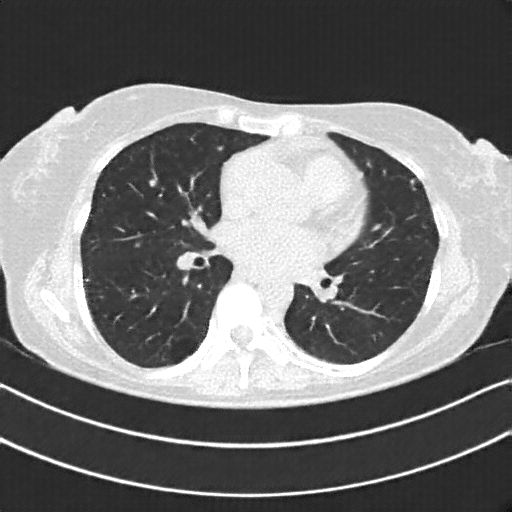 Generated VENOUS CT scan (A→B translation)