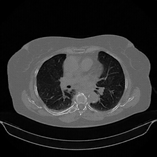 Generated VENOUS CT scan (A→B translation)