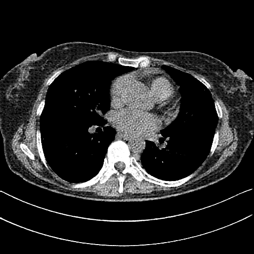 Generated VENOUS CT scan (A→B translation)