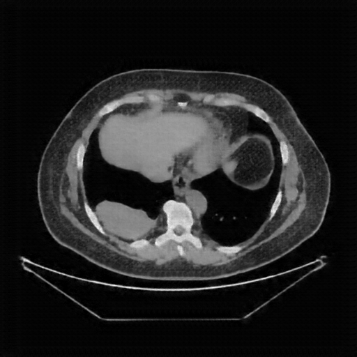 Generated VENOUS CT scan (A→B translation)