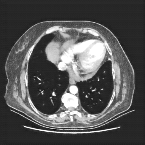 Generated VENOUS CT scan (A→B translation)