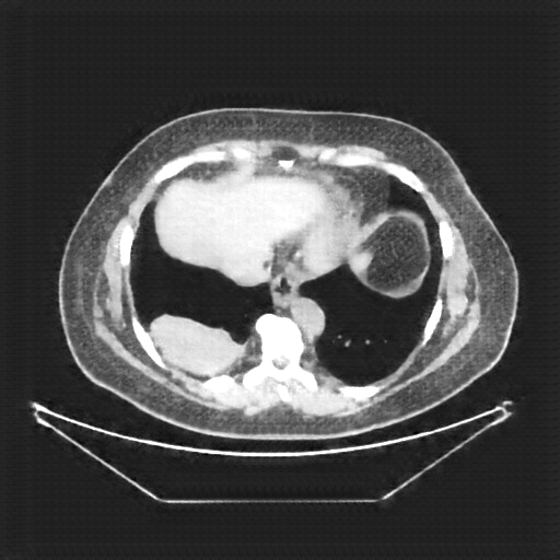 Generated VENOUS CT scan (A→B translation)