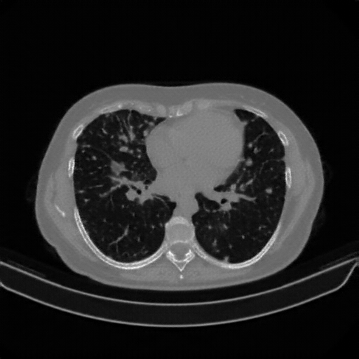 Generated VENOUS CT scan (A→B translation)