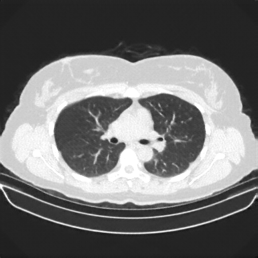 Generated VENOUS CT scan (A→B translation)