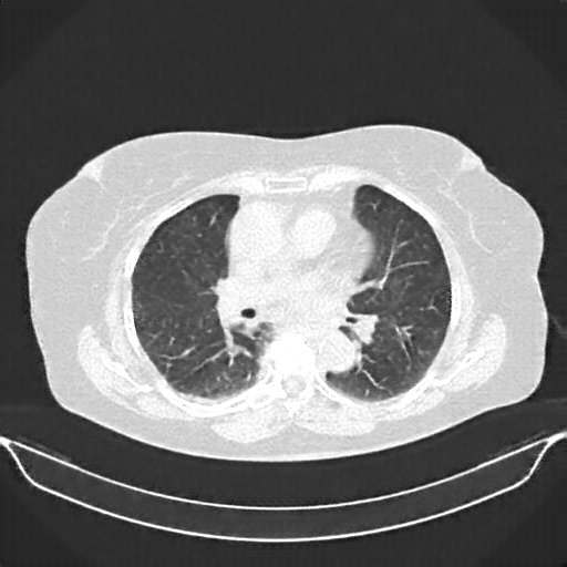 Generated VENOUS CT scan (A→B translation)