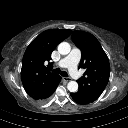 Original VENOUS CT scan