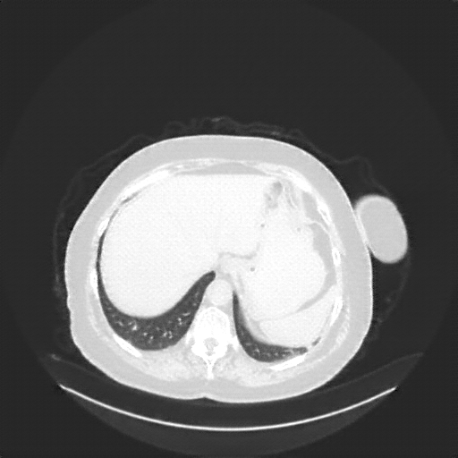 Generated VENOUS CT scan (A→B translation)