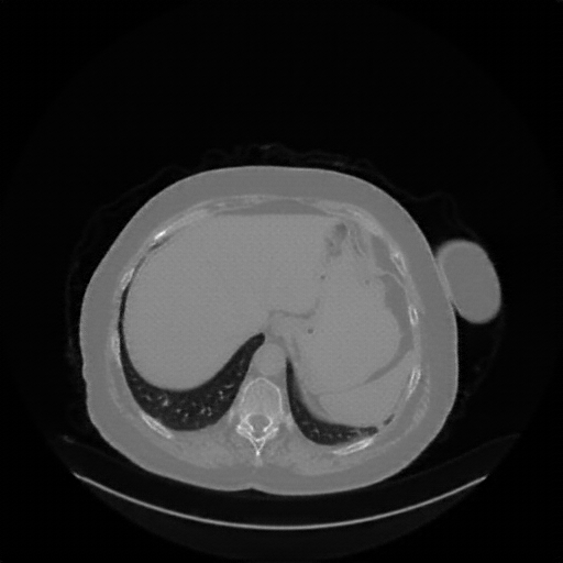 Generated VENOUS CT scan (A→B translation)