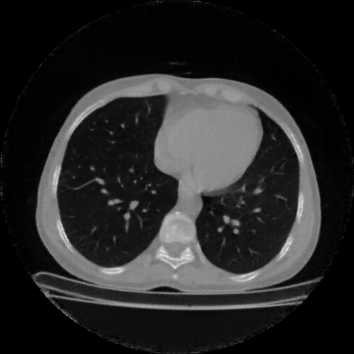 Generated VENOUS CT scan (A→B translation)