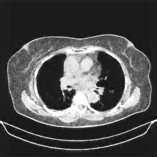 Generated VENOUS CT scan (A→B translation)