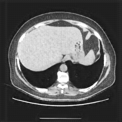 Generated VENOUS CT scan (A→B translation)