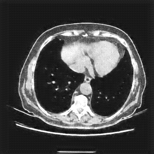 Generated VENOUS CT scan (A→B translation)