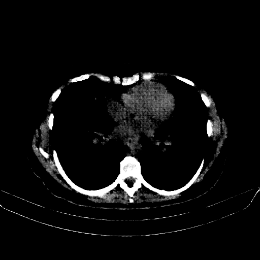 Generated VENOUS CT scan (A→B translation)