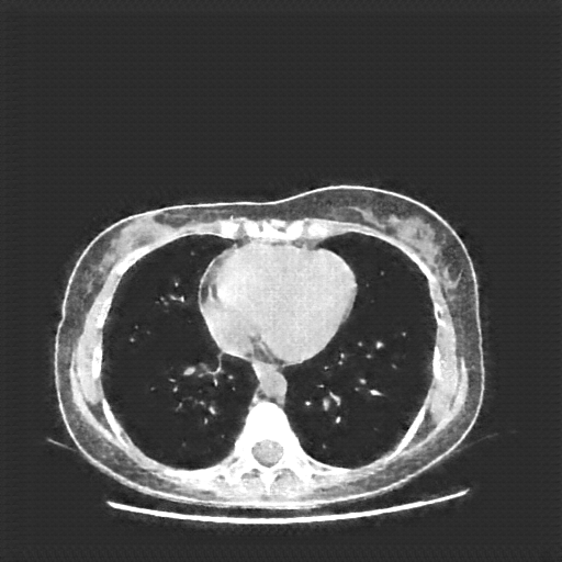 Generated VENOUS CT scan (A→B translation)