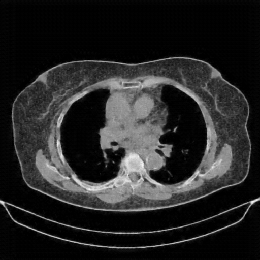 Generated VENOUS CT scan (A→B translation)