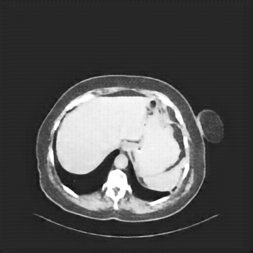 Reconstructed NATIVE CT scan (cycle consistency)