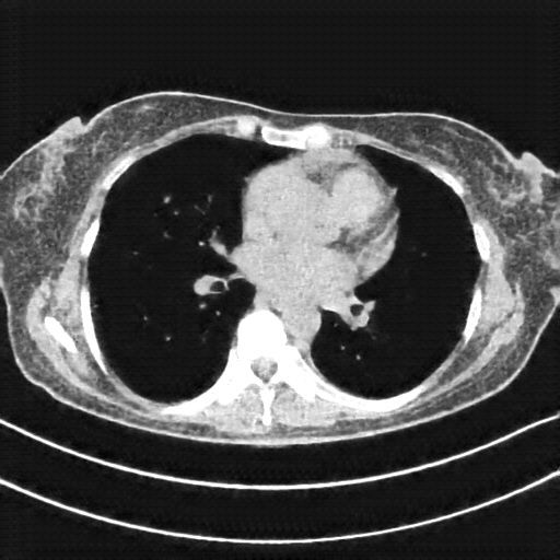 Generated VENOUS CT scan (A→B translation)