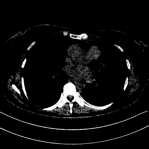 Generated VENOUS CT scan (A→B translation)