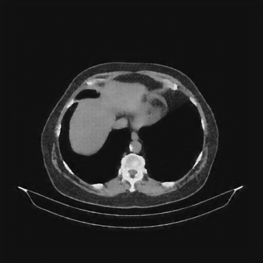 Generated VENOUS CT scan (A→B translation)