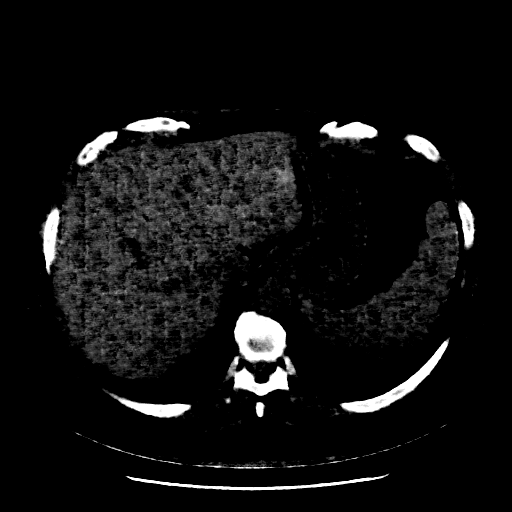 Generated VENOUS CT scan (A→B translation)