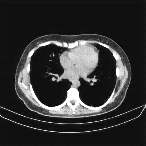 Generated VENOUS CT scan (A→B translation)