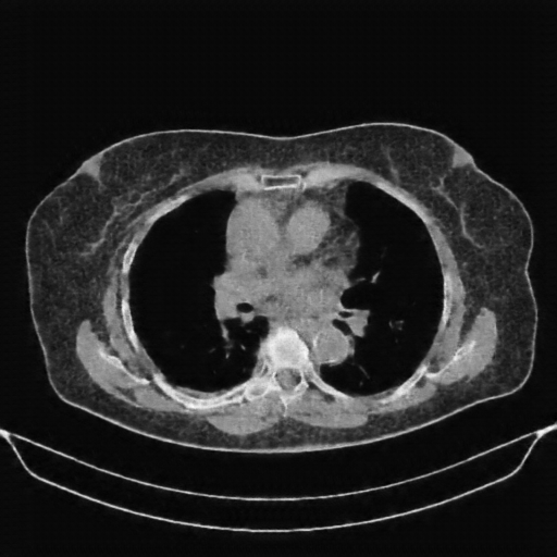 Generated VENOUS CT scan (A→B translation)