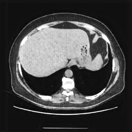 Generated VENOUS CT scan (A→B translation)