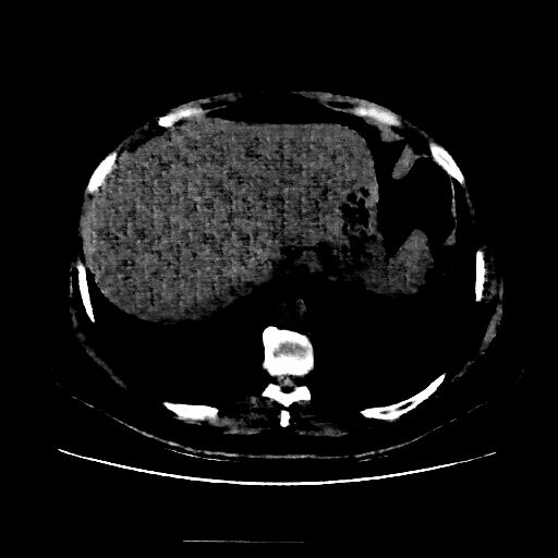 Generated VENOUS CT scan (A→B translation)