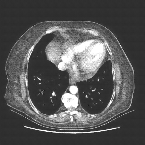 Generated VENOUS CT scan (A→B translation)
